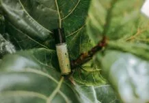 CBD Duct Dilatation Explained: Causes, Symptoms, and Treatments